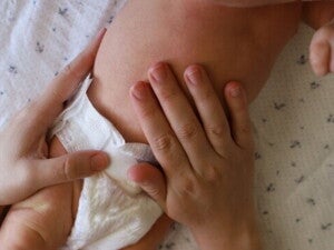 Ciri ciri Alergi Susu Formula yang Harus Diketahui Orang Tua  