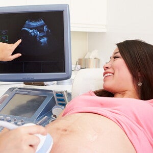 Cara agar cepat hamil