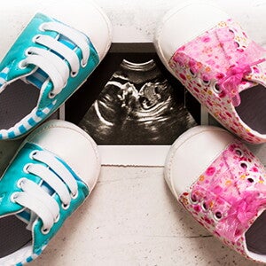 Merencanakan Persalinan Anak Kembar