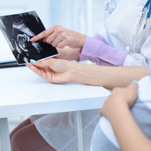 Bagaimana Cara Baca Hasil USG pada Kehamilan? Simak di Sini!