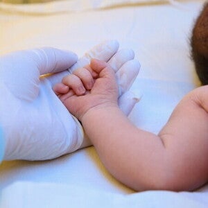 Cara Mencegah Bayi Kuning: Ini Langkah-Langkah Penting